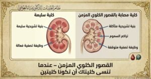 القصور الكلوي المزمن